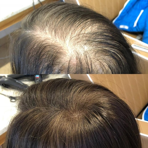 System włosy syntetyczne 15–40 cm, baza 17,5x17 cm – mikroklipsy