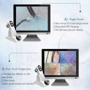 Powiększenie 200x kamera trychologiczna