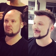 Męski system włosów naturalnych indyjskich – baza 24x18