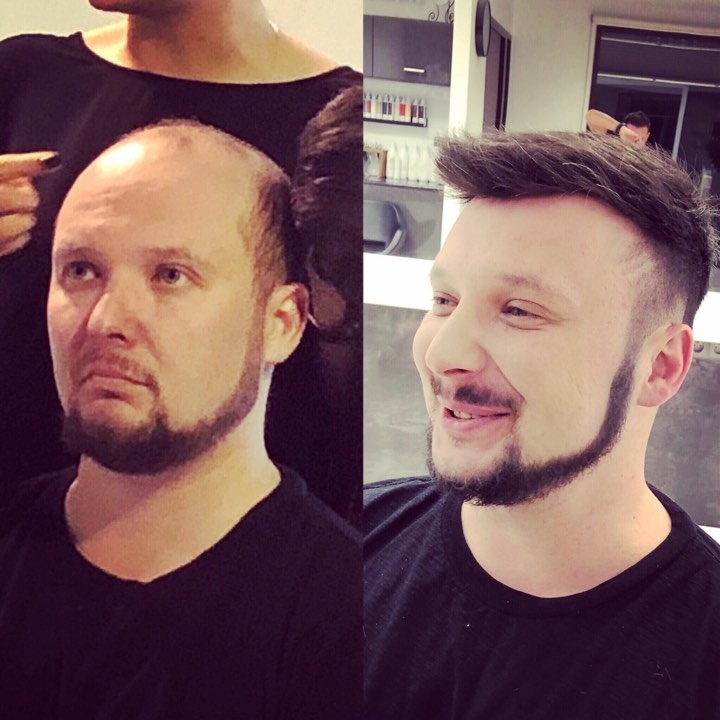 Męski system włosów naturalnych indyjskich – baza 24x18